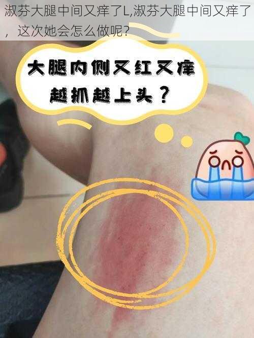 淑芬大腿中间又痒了L,淑芬大腿中间又痒了，这次她会怎么做呢？