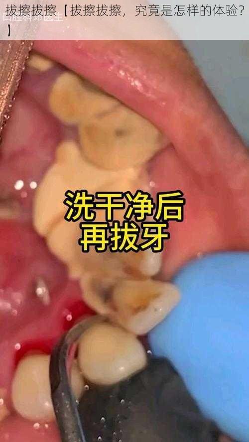 拔擦拔擦【拔擦拔擦，究竟是怎样的体验？】